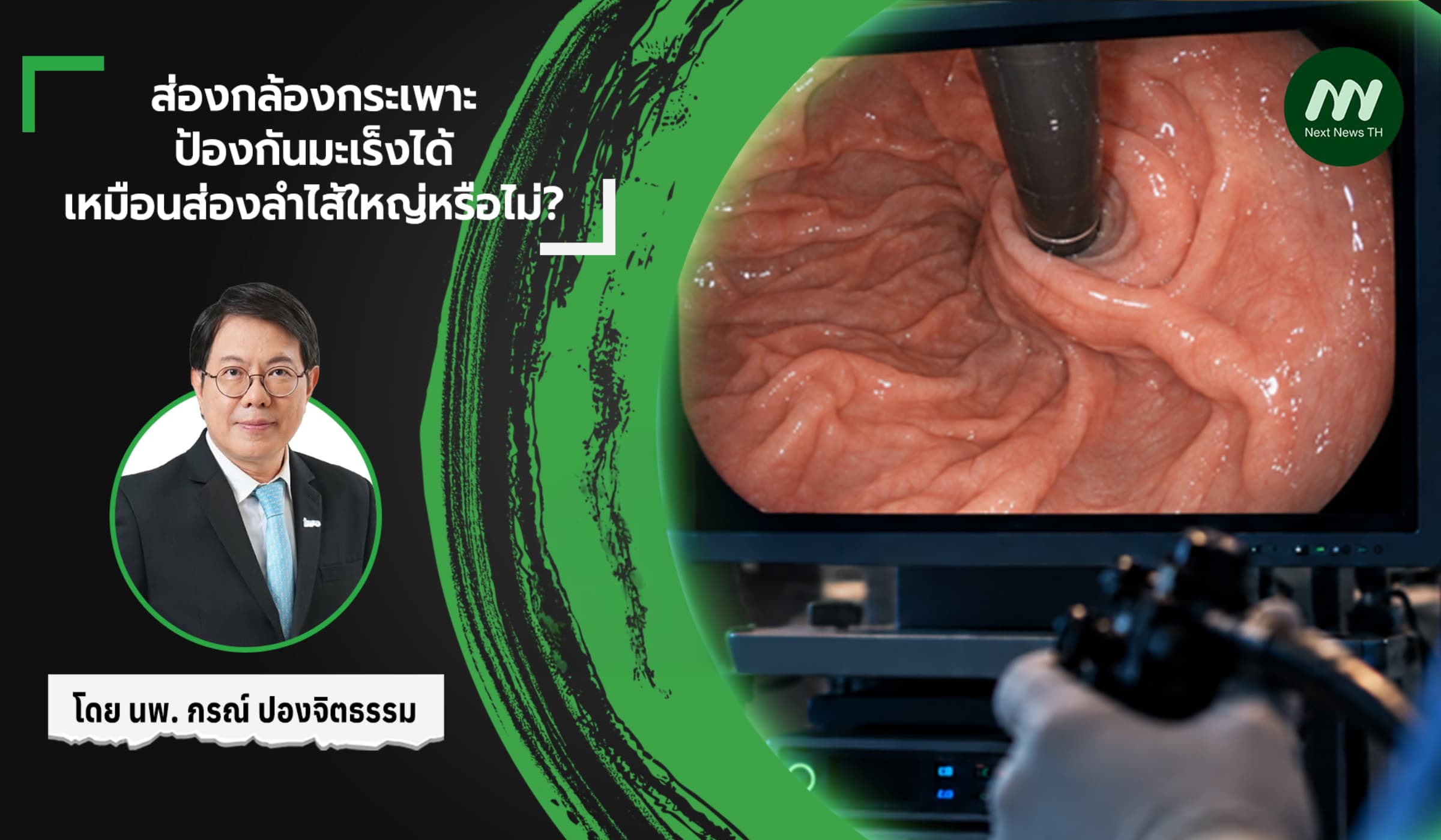 ส่องกล้องกระเพาะ ป้องกันมะเร็งได้เหมือนส่องลำไส้ใหญ่หรือไม่?