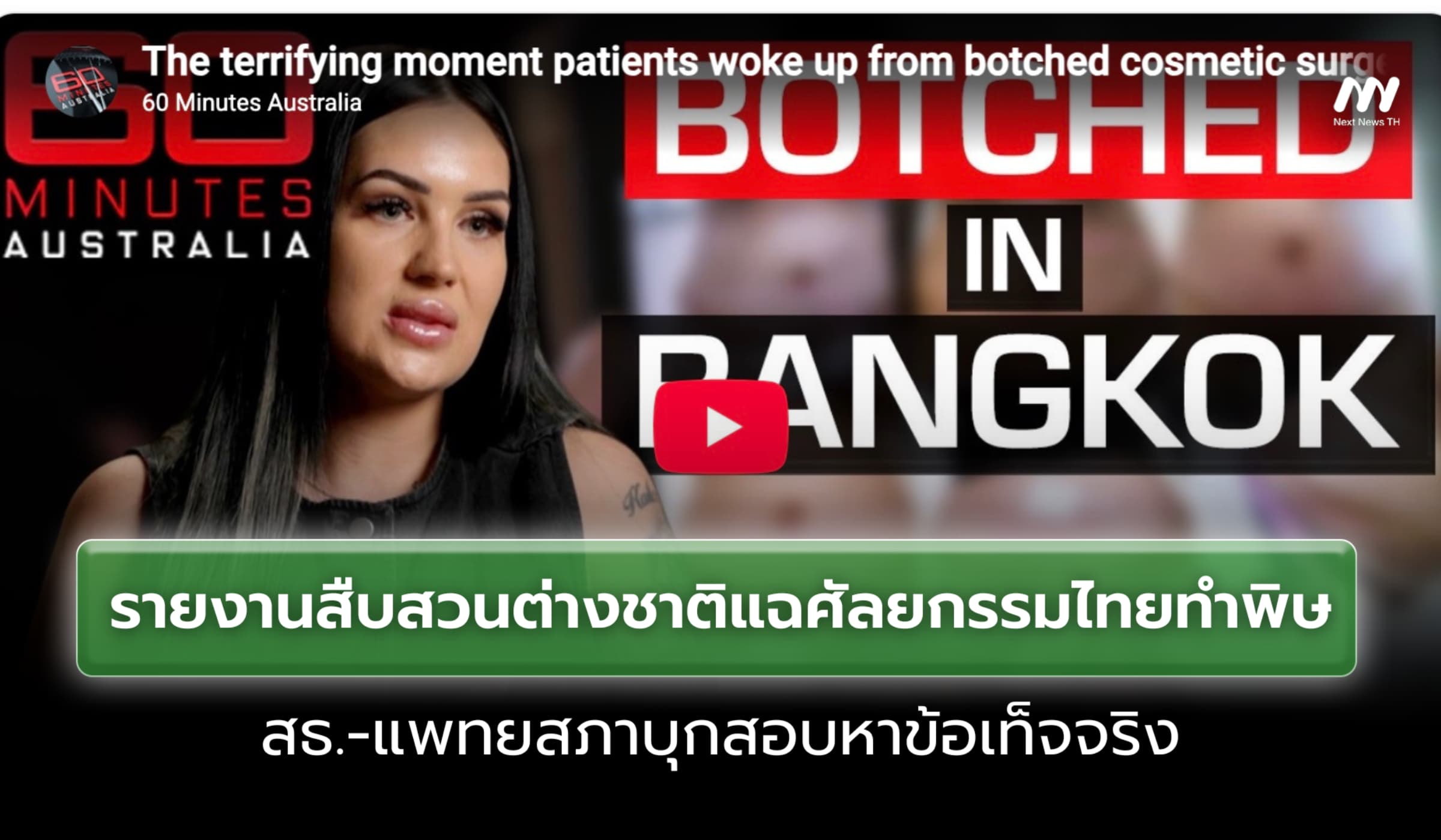 รายงานสืบสวนต่างชาติแฉศัลยกรรมไทยทำพิษ สธ.-แพทยสภาบุกสอบหาข้อเท็จจริง